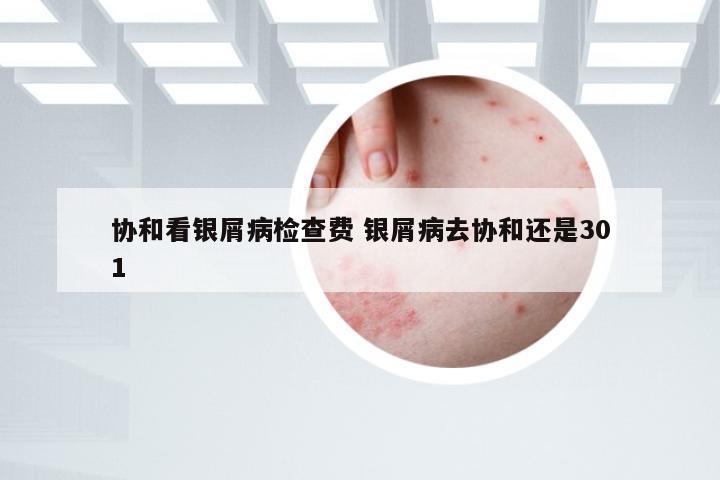 协和看银屑病检查费 银屑病去协和还是301
