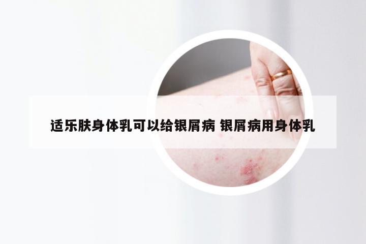 适乐肤身体乳可以给银屑病 银屑病用身体乳