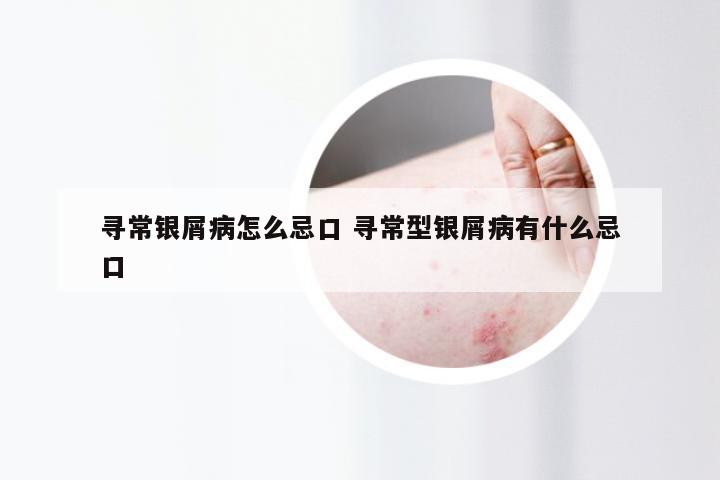 寻常银屑病怎么忌口 寻常型银屑病有什么忌口