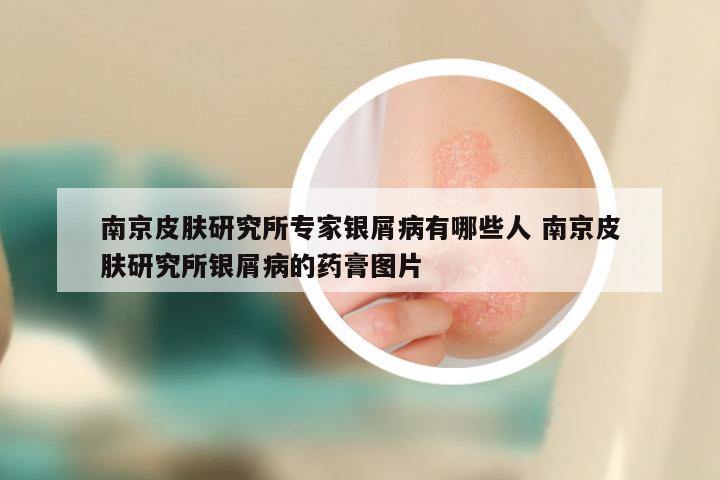 南京皮肤研究所专家银屑病有哪些人 南京皮肤研究所银屑病的药膏图片