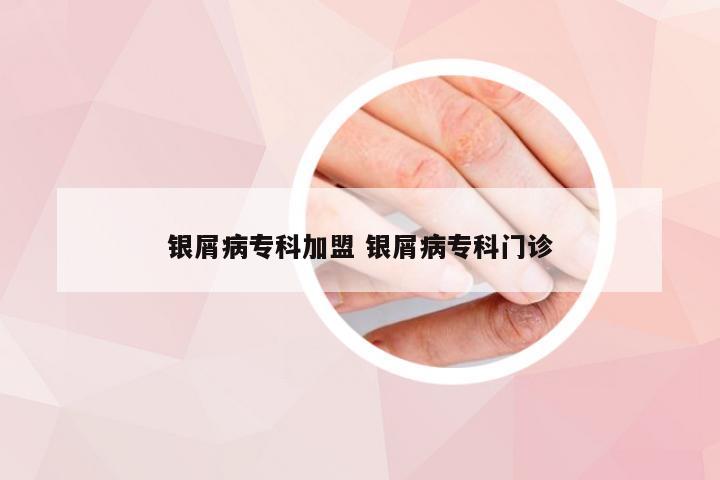 银屑病专科加盟 银屑病专科门诊