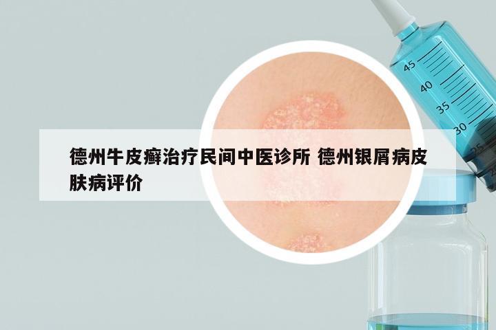 德州牛皮癣治疗民间中医诊所 德州银屑病皮肤病评价