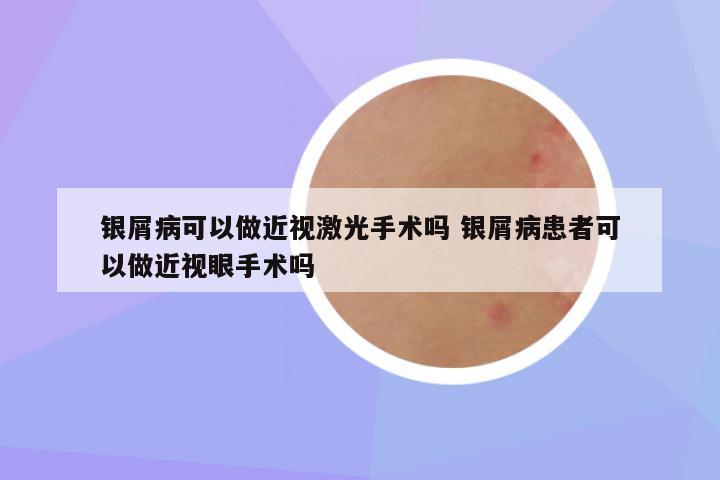 银屑病可以做近视激光手术吗 银屑病患者可以做近视眼手术吗