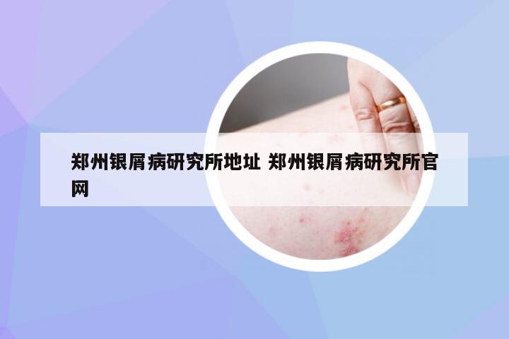 郑州银屑病研究所地址 郑州银屑病研究所官网