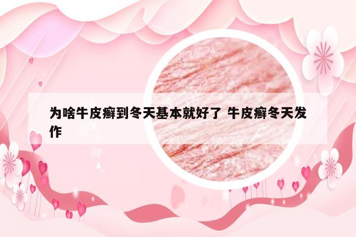 为啥牛皮癣到冬天基本就好了 牛皮癣冬天发作