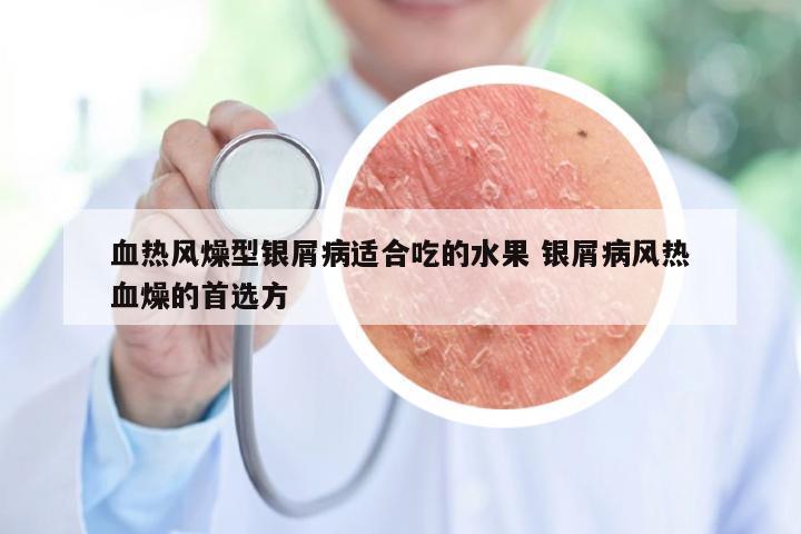 血热风燥型银屑病适合吃的水果 银屑病风热血燥的首选方