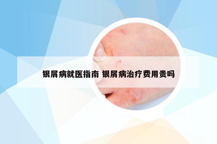 银屑病就医指南 银屑病治疗费用贵吗