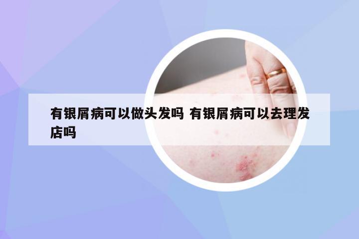 有银屑病可以做头发吗 有银屑病可以去理发店吗