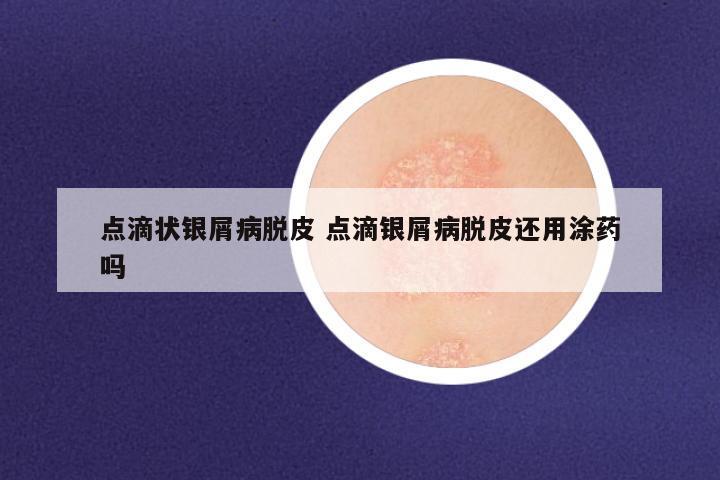 点滴状银屑病脱皮 点滴银屑病脱皮还用涂药吗