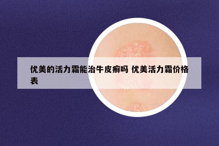 优美的活力霜能治牛皮癣吗 优美活力霜价格表