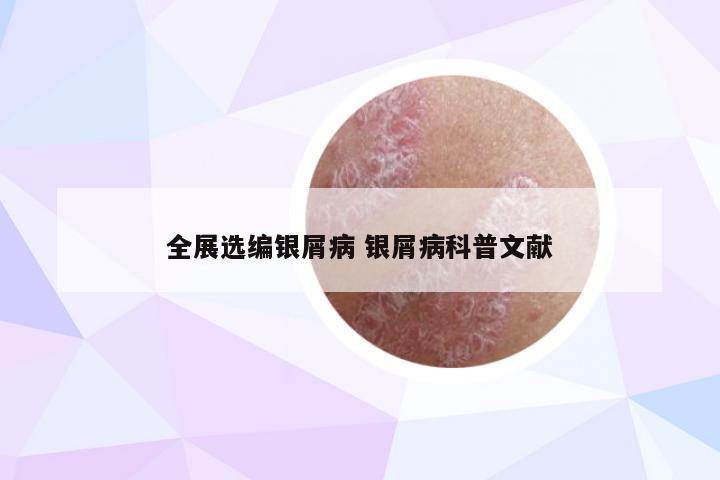 全展选编银屑病 银屑病科普文献
