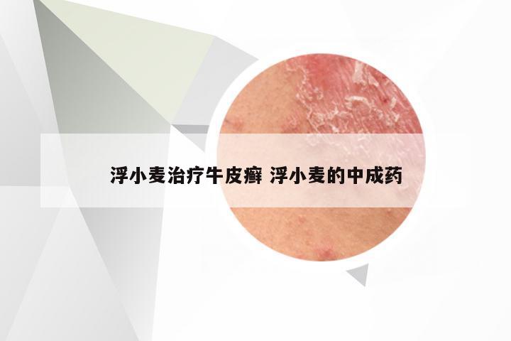 浮小麦治疗牛皮癣 浮小麦的中成药