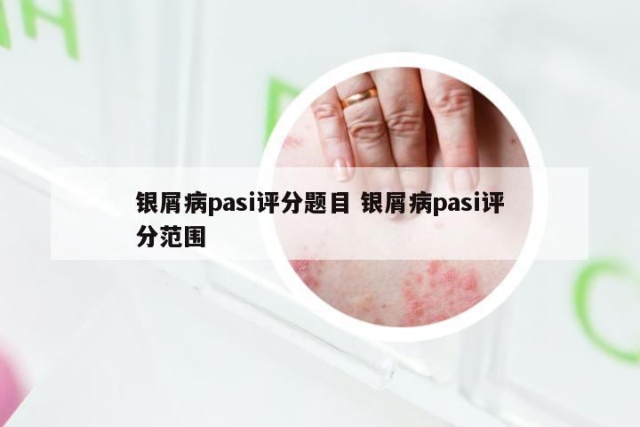 银屑病pasi评分题目 银屑病pasi评分范围