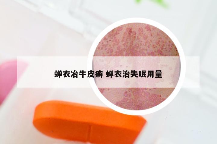 蝉衣冶牛皮癣 蝉衣治失眠用量