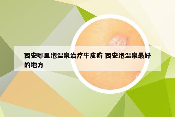 西安哪里泡温泉治疗牛皮癣 西安泡温泉最好的地方