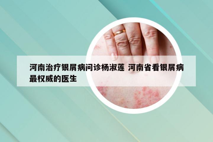 河南治疗银屑病问诊杨淑莲 河南省看银屑病最权威的医生