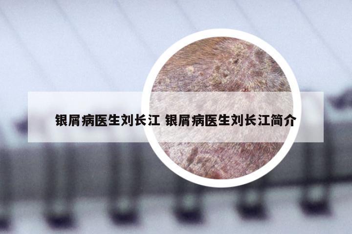 银屑病医生刘长江 银屑病医生刘长江简介