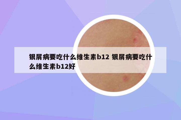 银屑病要吃什么维生素b12 银屑病要吃什么维生素b12好