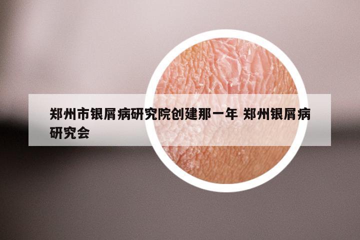 郑州市银屑病研究院创建那一年 郑州银屑病研究会