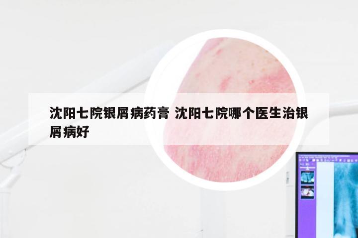 沈阳七院银屑病药膏 沈阳七院哪个医生治银屑病好
