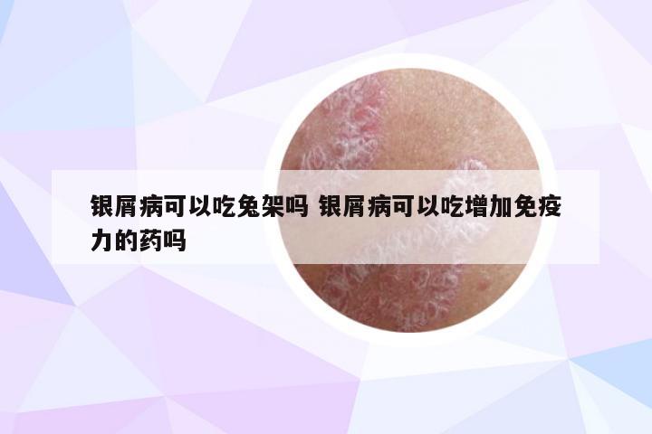 银屑病可以吃兔架吗 银屑病可以吃增加免疫力的药吗