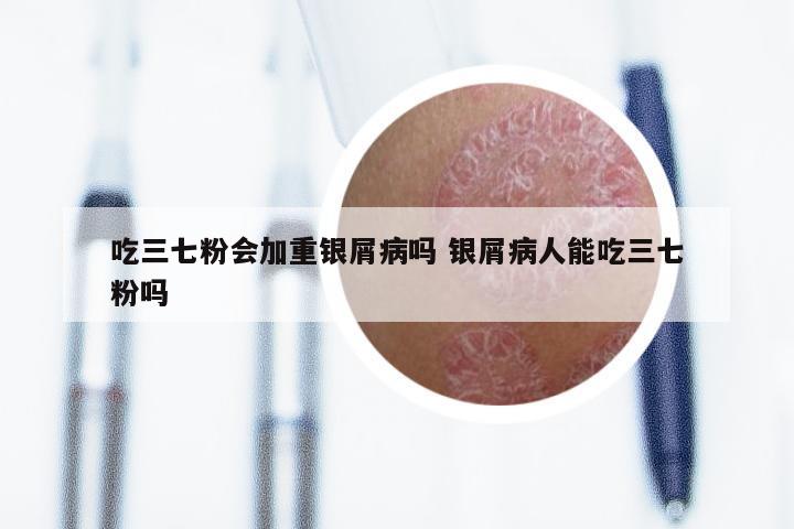 吃三七粉会加重银屑病吗 银屑病人能吃三七粉吗