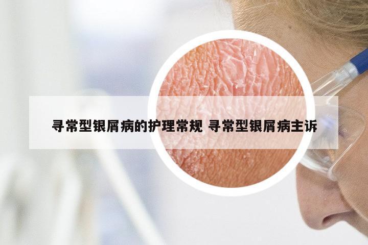 寻常型银屑病的护理常规 寻常型银屑病主诉