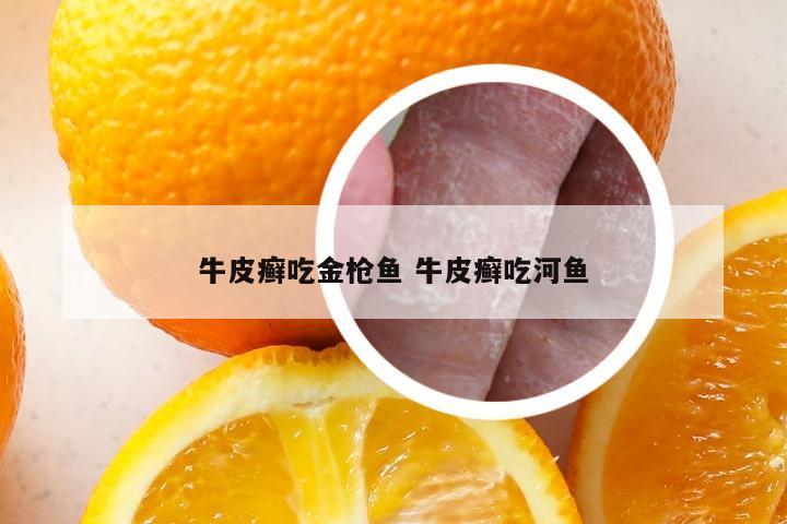 牛皮癣吃金枪鱼 牛皮癣吃河鱼