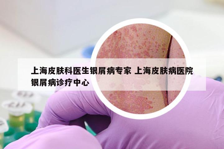 上海皮肤科医生银屑病专家 上海皮肤病医院银屑病诊疗中心