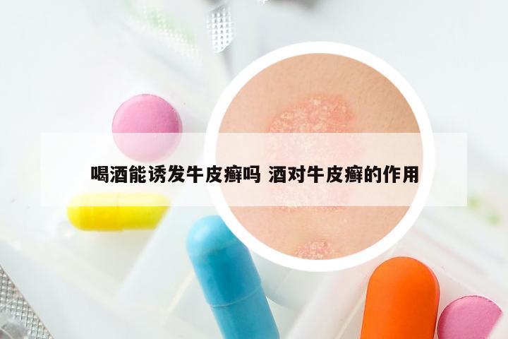 喝酒能诱发牛皮癣吗 酒对牛皮癣的作用