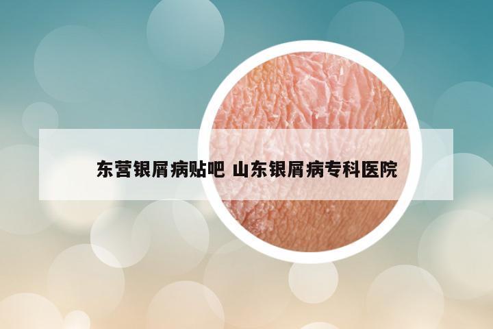 东营银屑病贴吧 山东银屑病专科医院