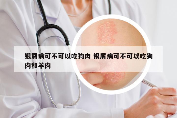 银屑病可不可以吃狗肉 银屑病可不可以吃狗肉和羊肉