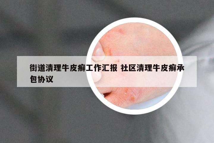 街道清理牛皮癣工作汇报 社区清理牛皮癣承包协议