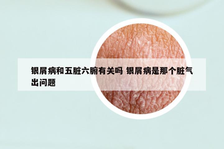 银屑病和五脏六腑有关吗 银屑病是那个脏气出问题