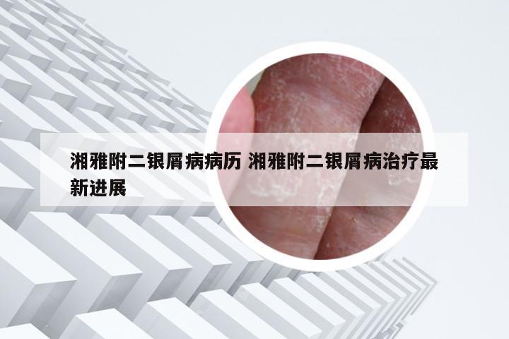 湘雅附二银屑病病历 湘雅附二银屑病治疗最新进展