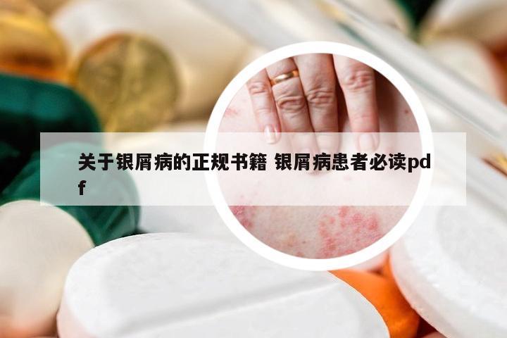 关于银屑病的正规书籍 银屑病患者必读pdf