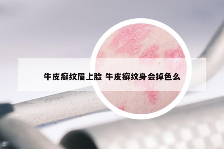 牛皮癣纹眉上脸 牛皮癣纹身会掉色么