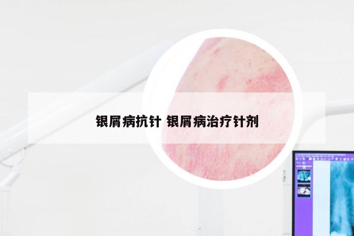 银屑病抗针 银屑病治疗针剂