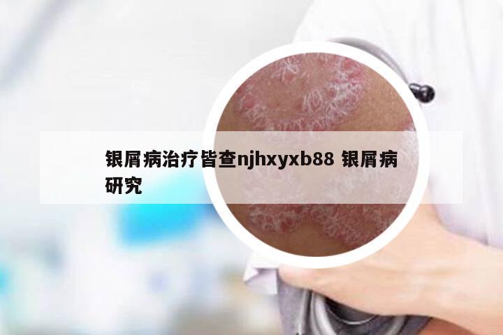 银屑病治疗皆查njhxyxb88 银屑病研究