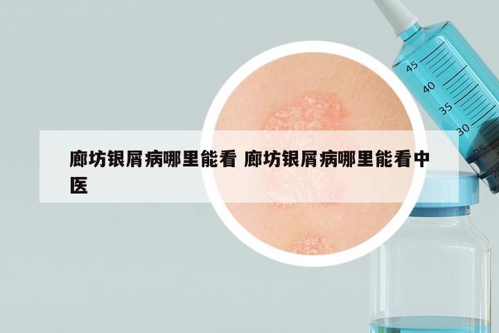 廊坊银屑病哪里能看 廊坊银屑病哪里能看中医