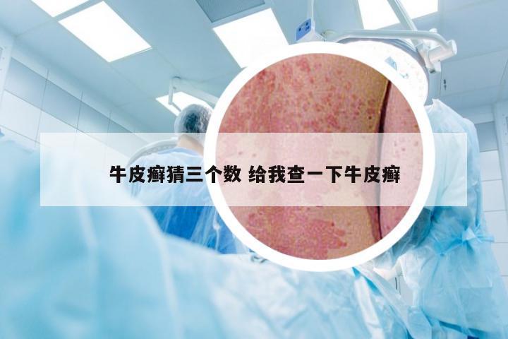 牛皮癣猜三个数 给我查一下牛皮癣