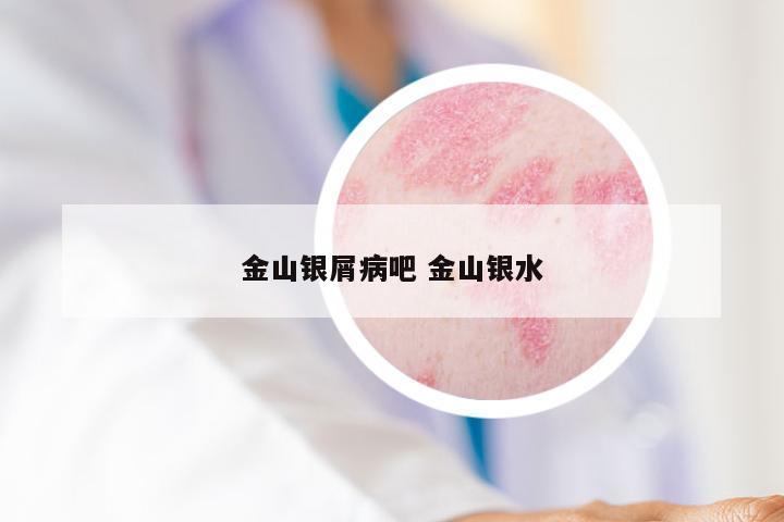 金山银屑病吧 金山银水