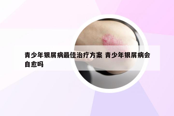 青少年银屑病最佳治疗方案 青少年银屑病会自愈吗