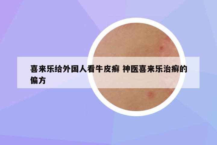 喜来乐给外国人看牛皮癣 神医喜来乐治癣的偏方