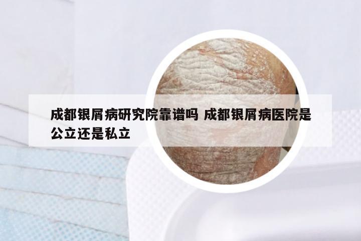 成都银屑病研究院靠谱吗 成都银屑病医院是公立还是私立