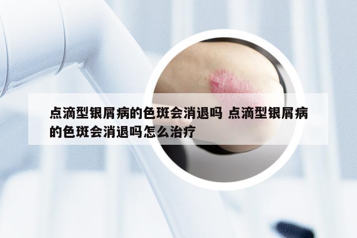 点滴型银屑病的色斑会消退吗 点滴型银屑病的色斑会消退吗怎么治疗