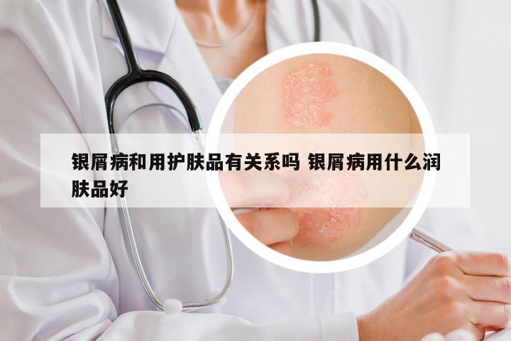银屑病和用护肤品有关系吗 银屑病用什么润肤品好