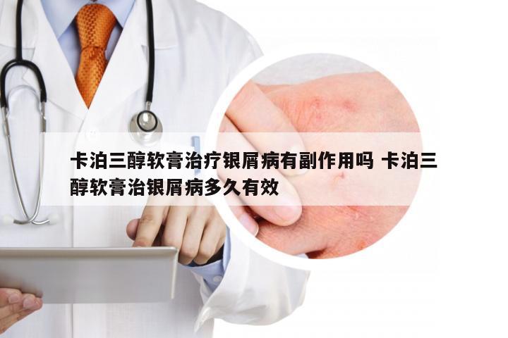 卡泊三醇软膏治疗银屑病有副作用吗 卡泊三醇软膏治银屑病多久有效