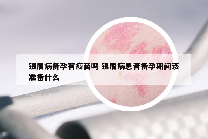 银屑病备孕有疫苗吗 银屑病患者备孕期间该准备什么