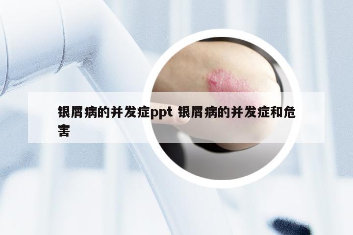 银屑病的并发症ppt 银屑病的并发症和危害